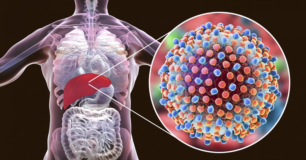 Everything you need to know about hepatitis | RxWiki