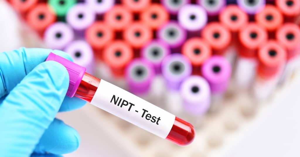 FDA warns public about potential risks of non-invasive prenatal screening tests | RxWiki