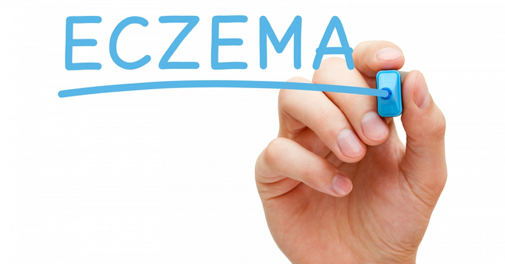 Everything you need to know about eczema | RxWiki