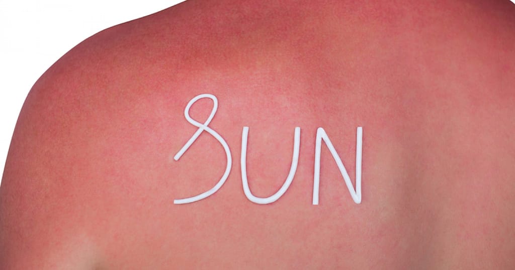 Sunburn and sunscreen safety tips to keep your family safe and having fun | RxWiki