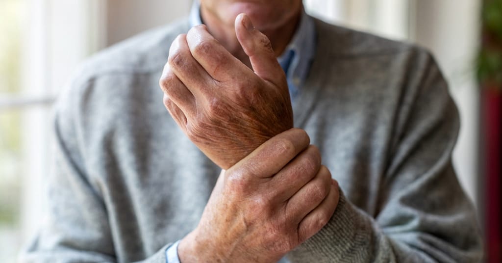 With arthritis on the rise in the US, health officials recommend some strategies | RxWiki