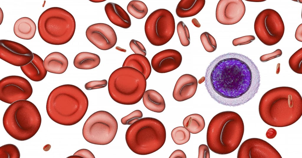 Iron deficiency anemia can be problematic, but you can spot it if you know the signs | RxWiki