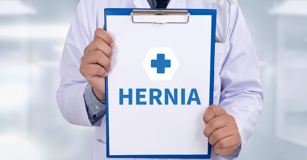 What you need to know about hernias this National Hernia Awareness Month | RxWiki