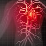 Men and women both show the top three heart attack symptoms | RxWiki